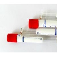 特價供應 小牛胸腺DNA  廠家直銷