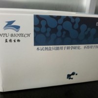人性激素結(jié)合蛋白（SHBG）定量檢測(cè)試劑盒（ELISA）