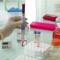 ScreenCell® CC循環(huán)細(xì)胞分離培養(yǎng)套裝