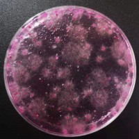 霉菌酵母菌檢測皿