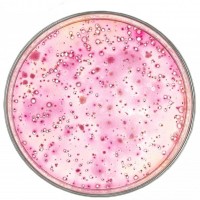 食品微生物大腸菌群（VRBA）檢測